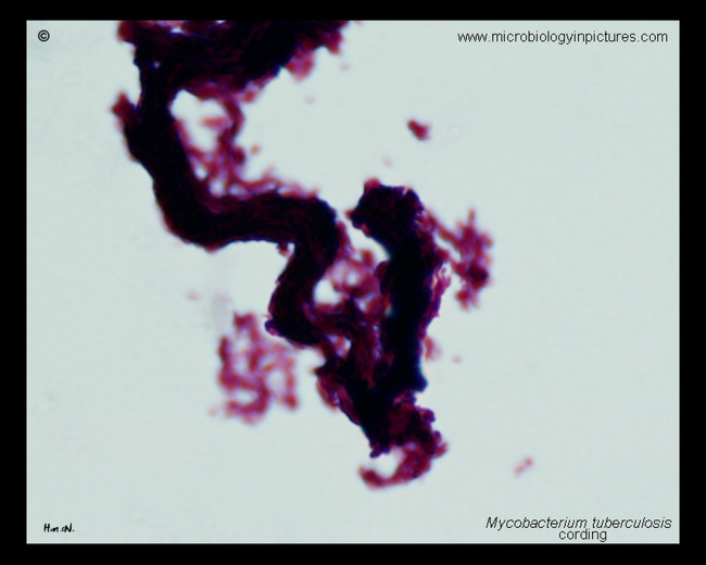acid-fast stain, cording